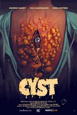 Cyst (2020) บรรยายไทยแปล - ดูหนังออนไลน