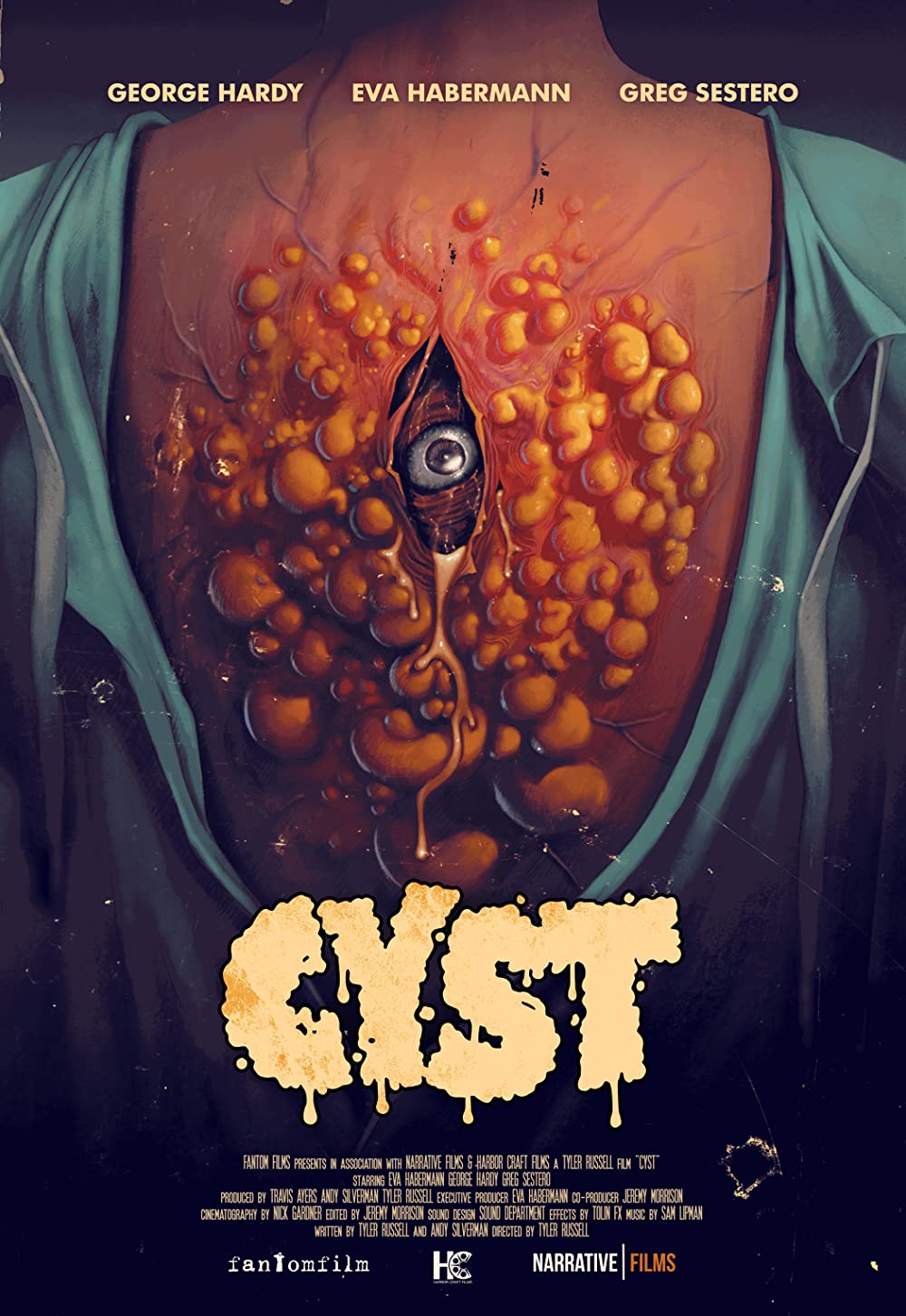 Cyst (2020) - ดูหนังออนไลน